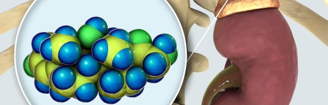 Colecistita: Cum apare boala, metode de preventie