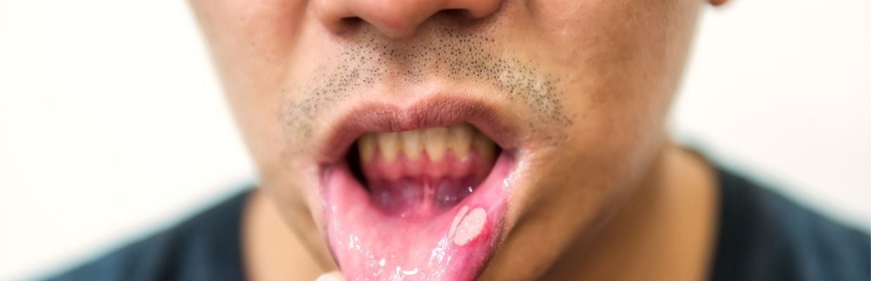 Diferenta dintre ulcer si gastrita