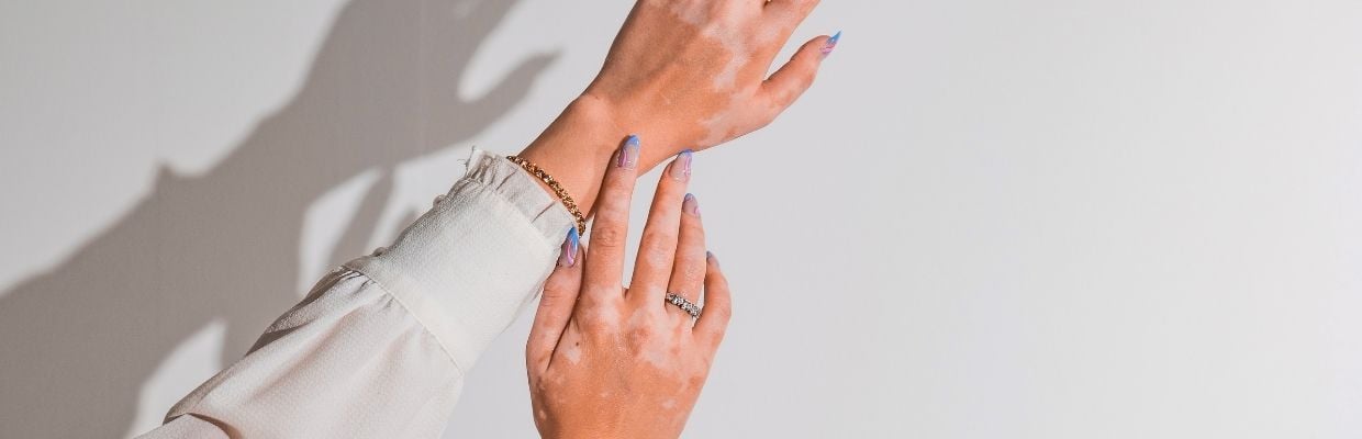 Este contagioasa dermatita atopica?