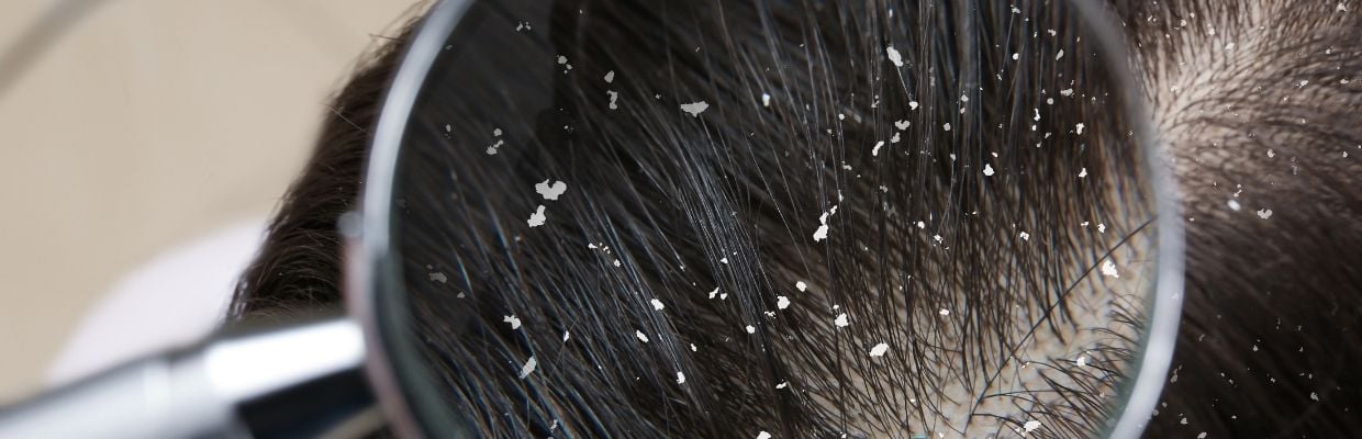 Tipuri de matreata si solutii de preventie