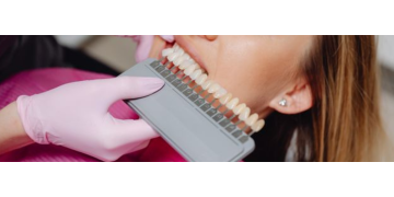 Implantul dentar vs. proteza dentară: Avantaje și dezavantaje. Cum facem alegerea
