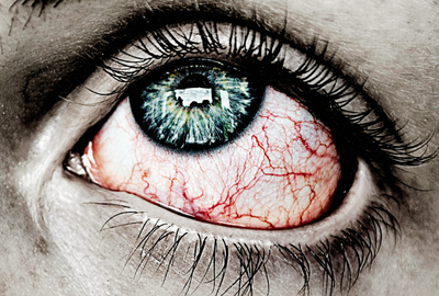 Retinopatia pigmentara: O boala genetica rara care duce la pierderea progresiva a vederii