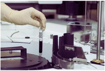 Scleroza amiotrofica laterala: Cum apare boala, simptome, tipuri de tratament