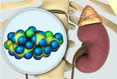 Boala Whipple: o afectiune rara care genereaza tulburari digestive. De ce apare