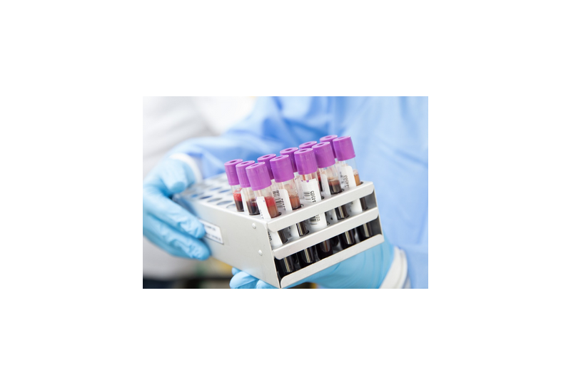 Calcitonina, un hormon implicat in reglarea metabolismului calciului. Ce trebuie sa retii