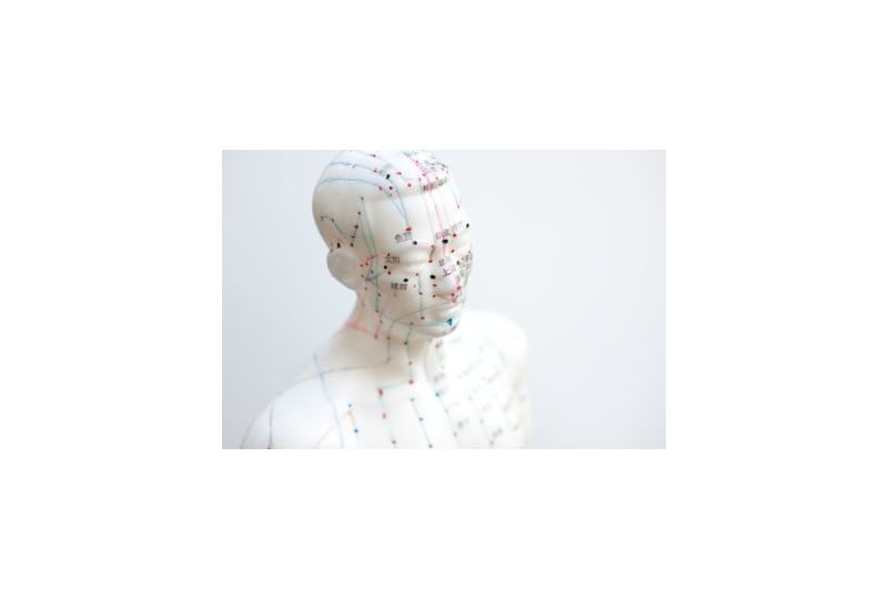 Acupunctura: Cum ajuta aceasta tehnica, cand se recomanda, ce trebuie sa stim inainte de orice procedura