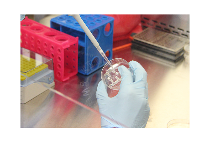 Albumina serica: un indicator important al functiei renale si hepatice
