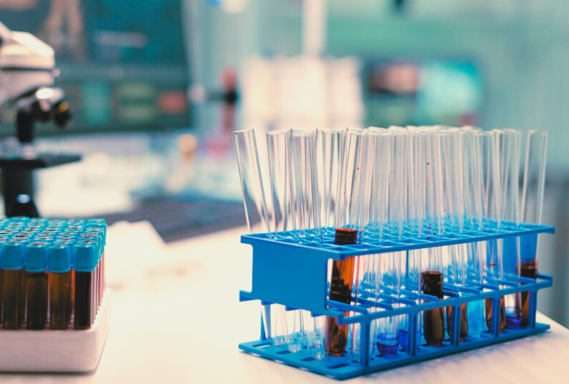 Proteina C Reactiva: Cum ajuta acest indicator, ce boli pot fi depistate cu ajutorul acesteia