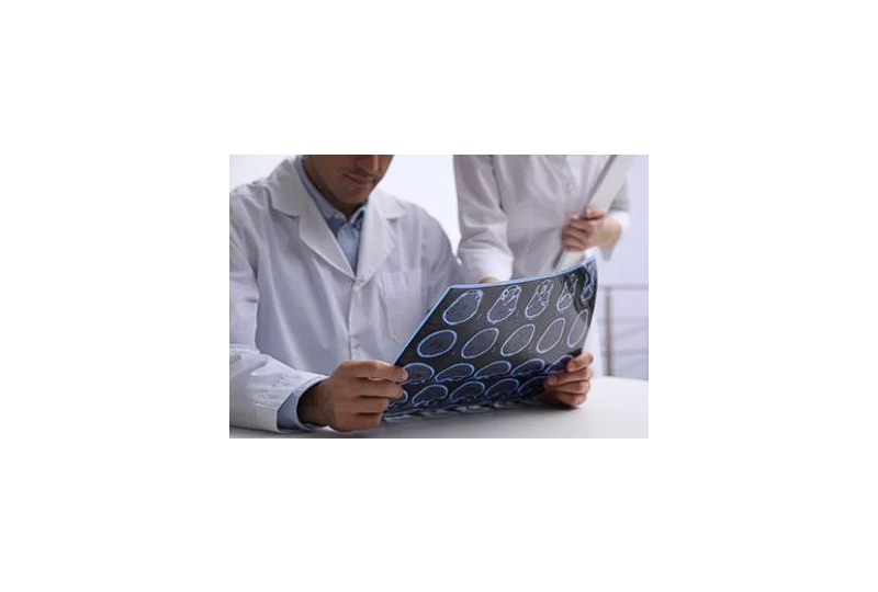 Calprotectina: un biomarker important pentru sanatatea intestinala