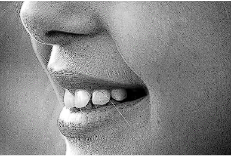 Disfagia: Cum apare boala, cum se poate preveni