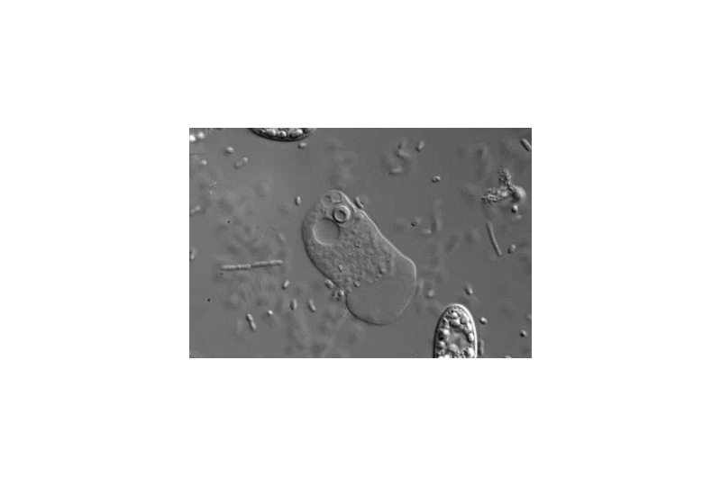 Fertilizarea in vitro: ce trebuie sa stii inainte de a apela la aceasta metoda