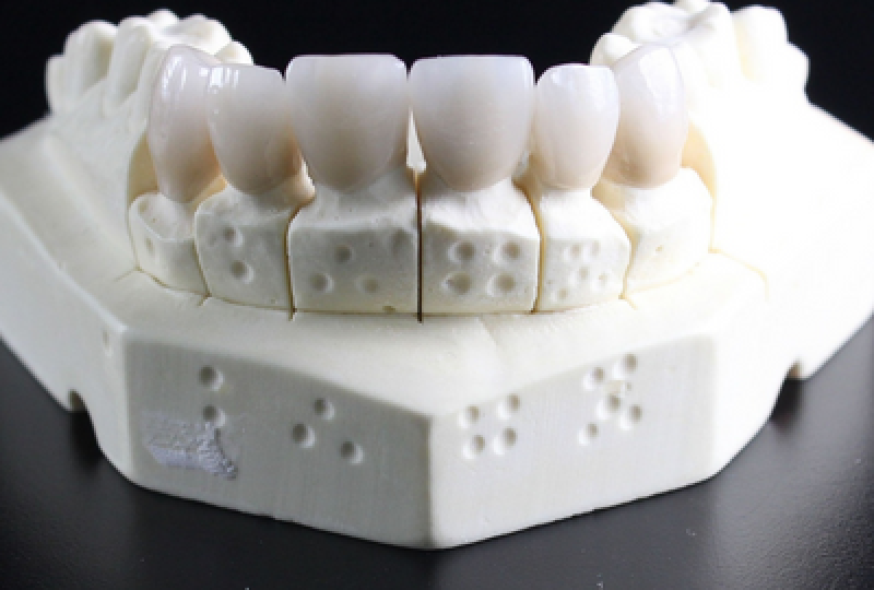 Gutiera dentara: ce rol are, cum se alege si cum se ingrijeste