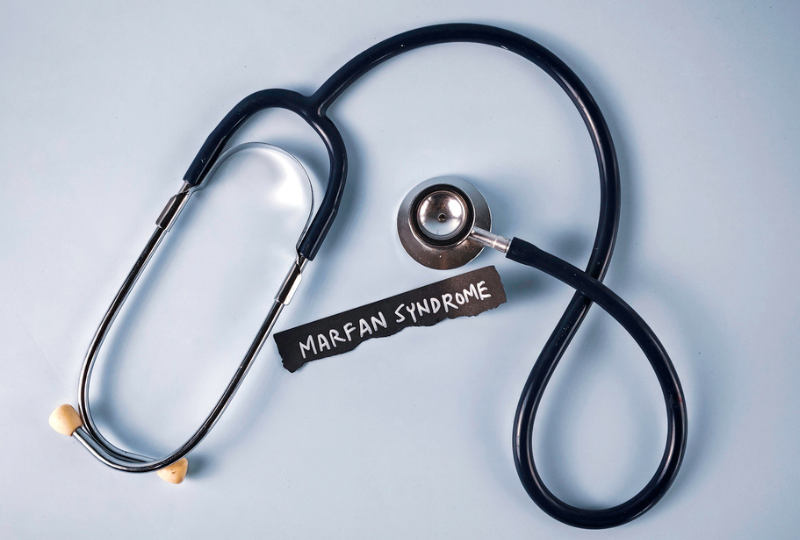 Sindromul Marfan: simptome, diagnostic si tratament