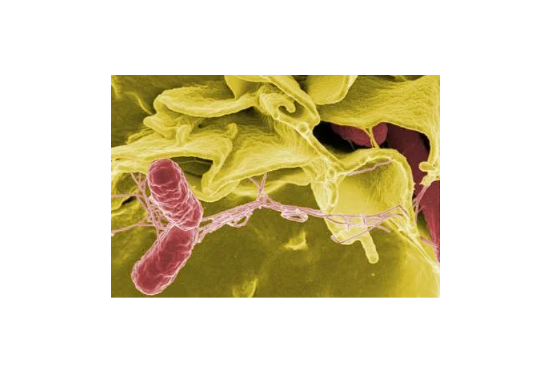 Azoospermia: cauze, diagnostic si optiuni de tratament