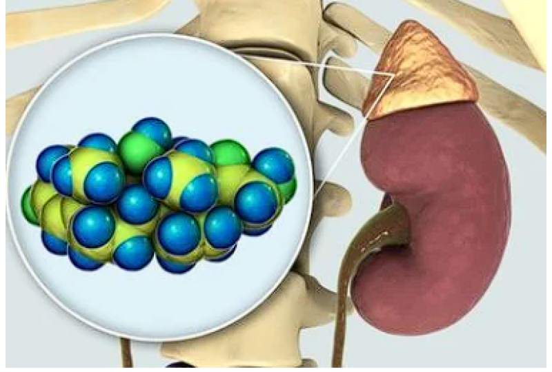 Diverticul Meckel: simptome, diagnostic si optiuni terapeutice