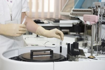 Hemograma: ce este, ce boli se pot depista cu ajutorul acestei investigatii