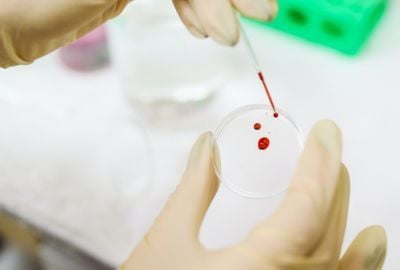 Hemofilia: Cum apare, preventie, simptome