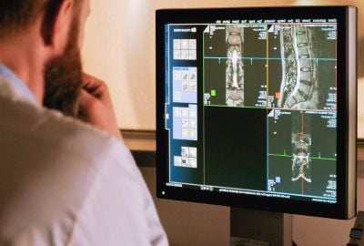 Boala Chédiak-Higashi: Diagnostic si optiuni de tratament