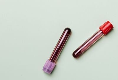 Grupele de sange si importanta lor. Cum afli grupa de sange