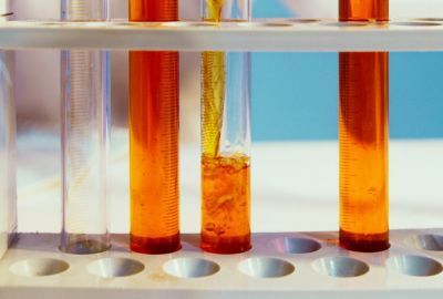 Boala Fabry: De ce apare, simptome, diagnostic