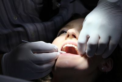 Sensibilitatea dentara: de ce apare, cum o recunosti, preventie si tratament