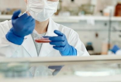 Limfomul Hodgkin sau cancerul limfatic: De ce apare, cum il recunosti