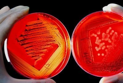 Util: diferente intre neurotoxine si hemotoxine