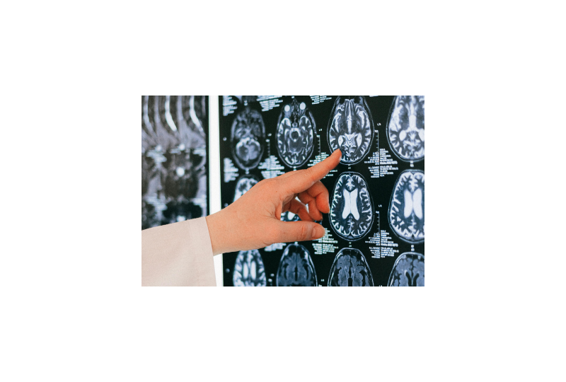 Arteriografia periferica: Ce este si cand se recomanda pentru diagnosticarea si tratarea bolilor vasculare