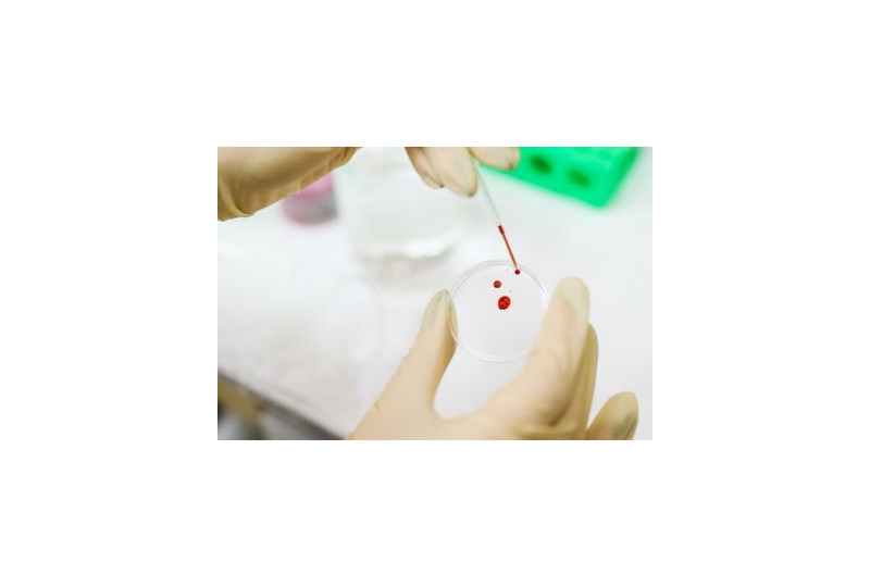Hemofilia: Cum apare, preventie, simptome