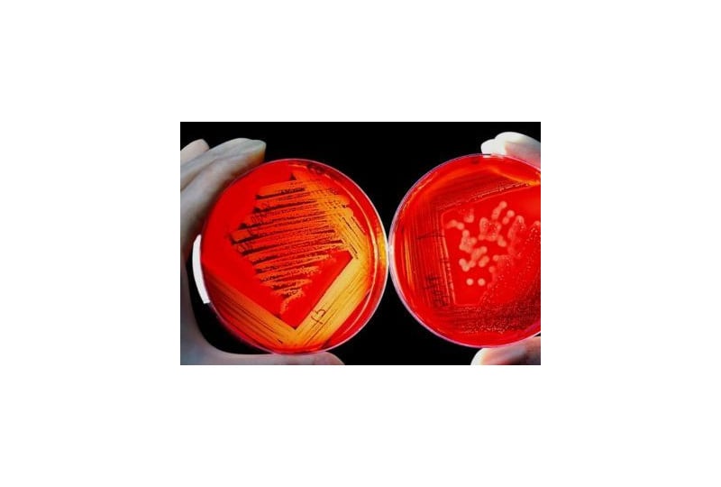 Util: diferente intre neurotoxine si hemotoxine