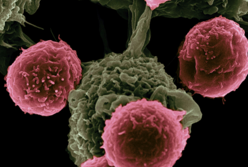 Neoplazia endocrina multipla (MEN): Cum recunosti afectiunea si cum se poate gestiona aceasta boala