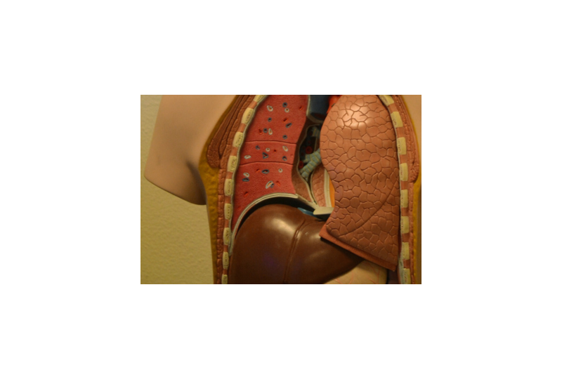 Steatohepatita nonalcoolica: Cum recunosti boala, de ce apare, metode de preventie si tratament