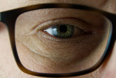 Afectiuni retiniene: ce sunt, cum se manifesta si ce riscuri implica