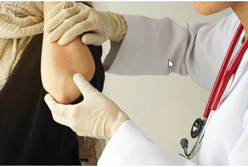Dermatita herpetiforma: ce este, care sunt simptomele si cum se poate trata