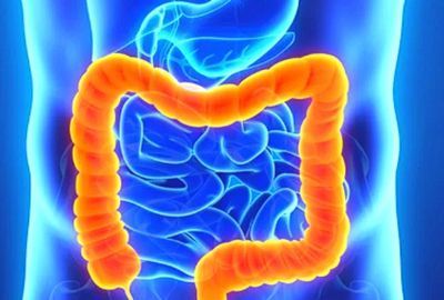 Condrosarcomul: O privire detaliata asupra acestei forme de cancer