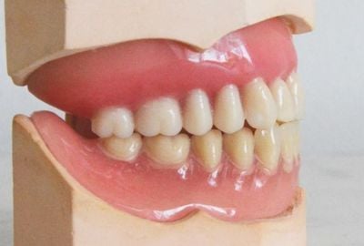 Mandibula: ce rol are si ce afectiuni ii sunt asociate