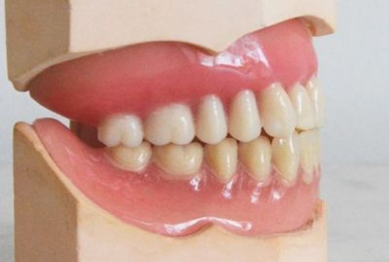 Mandibula: ce rol are si ce afectiuni ii sunt asociate