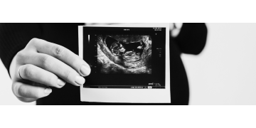 Monitorizarea greutatii in perioada sarcinii: De ce este importanta, cand stii ca trebuie sa mergi la medic