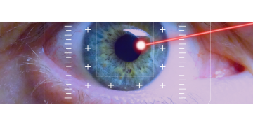 laser-in-ochi