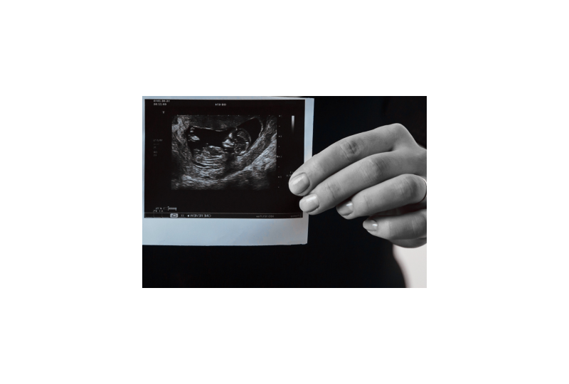 Monitorizarea greutatii in perioada sarcinii: De ce este importanta, cand stii ca trebuie sa mergi la medic