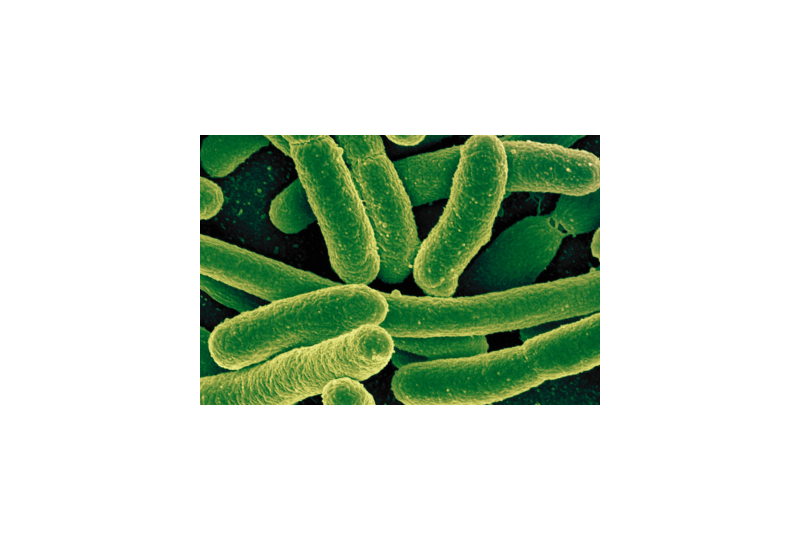 Infectia cu bacterii din genul Listeria: Cum apare, cum se trateaza si cum se poate evita
