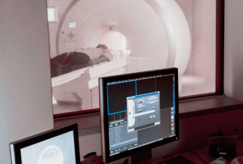 Computerul tomograf: Cand se recomanda pentru detectarea precoce a diferitelor patologii medicale