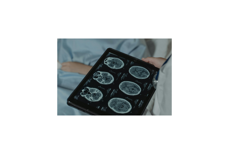 Craniofaringiomul: In ce conditii se formeaza aceasta tumoare rara, simptome, cum se poate gestiona afectiunea