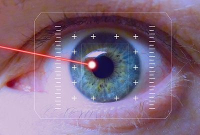 laser-in-ochi