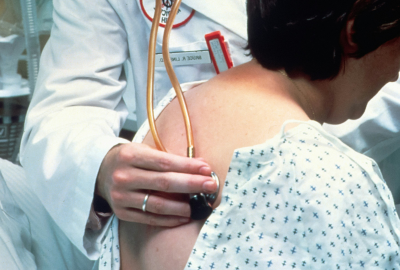 Ce alimente trebuie sa eviti daca ai primit diagnosticul de cancer pulmonar