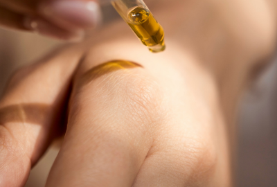 Eczematidele: simptome, cauze si optiuni de tratament