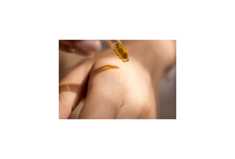 Eczematidele: simptome, cauze si optiuni de tratament