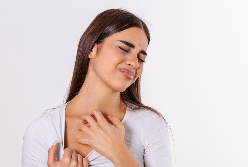 Urticaria: Ghid complet. Cum apare, simptome, poze, preventie si tratament