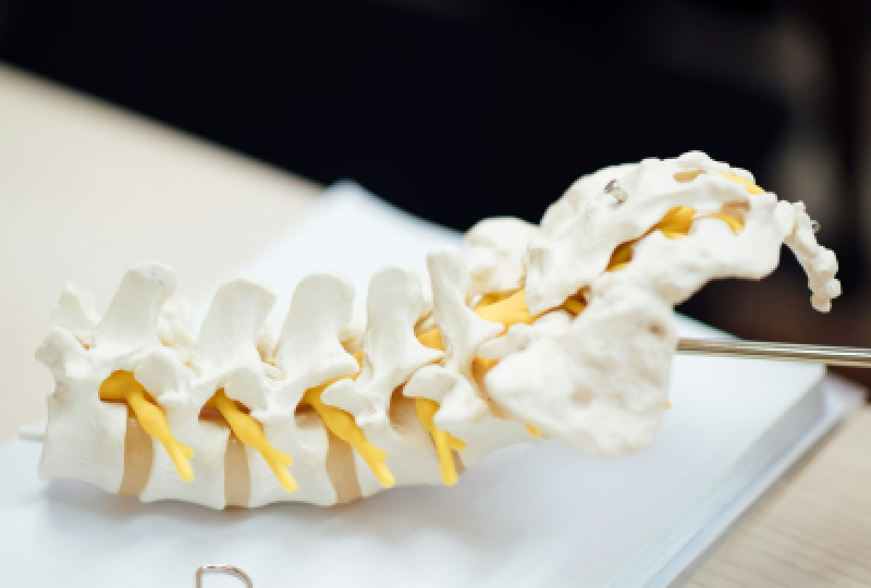 Osteomielita: tipuri, cauze, simptome si optiuni de tratament