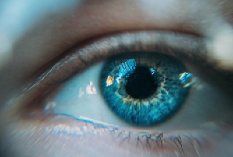 Hipopionul ocular: simptome, cauze si optiuni terapeutice